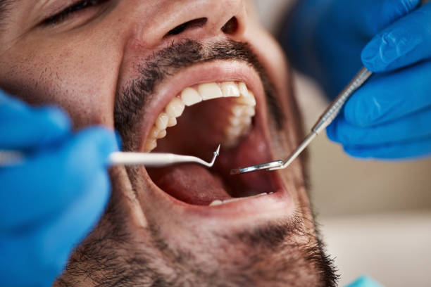 Best Broken or Cracked Tooth Emergency Dentist in Huron, OH